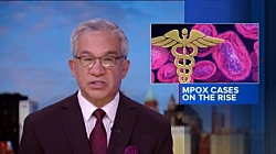 Департамент здравоохранения сообщает о значительном увеличении случаев заболевания оспой