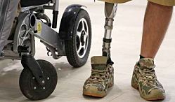 Россия утроила закупки протезов из-за массового появления инвалидов на фронте