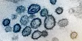 Их уже трое. Ученые выяснили, как мутировал коронавирус на пути из Китая в Европу