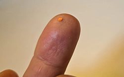 Слепота излечена с помощью «революционного» бионического чипа