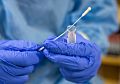 Устройство, способное выявить коронавирус за минуту, разработали в Словакии