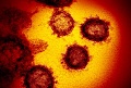 Ученые выяснили температуру гибели коронавируса