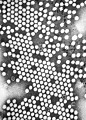 В США выявили первый с 1979 года случай заражения полиомиелитом